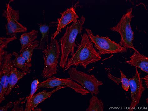 Edc4 Antibody 17737 1 Ap Proteintech 武汉三鹰生物技术有限公司