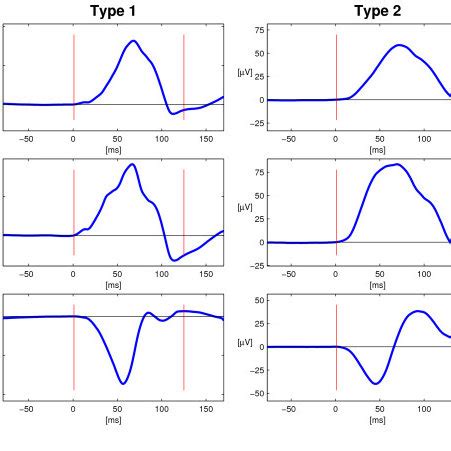 P wave morphology Type 1 and 2. The two principal orthogonal P wave... | Download Scientific Diagram