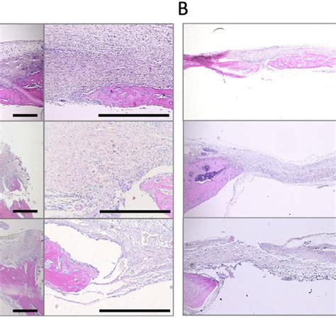 Histological Evaluation Of Bone Formation Following Implantation Of