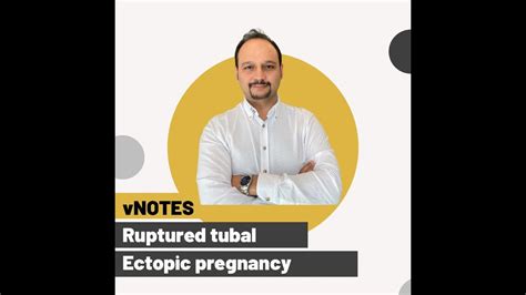 Management Of Ruptured Tubal Ectopic Pregnancy With Vnotes Approach