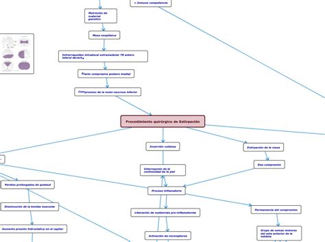 Procedimiento Quirúrgico De Extirpación Mind Map