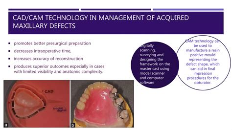 Prosthodontic Rehabilitation Of Maxillary Defect In A Patient Ppt