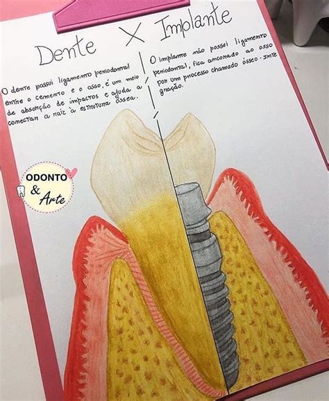 Pin De Camilla Fabri Em DENTAL ANATOMY Assistente De Dentista