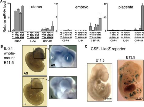 Differential Expression Of Csf 1 Il 34 And Csf 1r Mrna In Embryos And Download Scientific