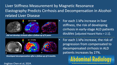 Liver Stiffness Measurement By Magnetic Resonance Elastography Predicts