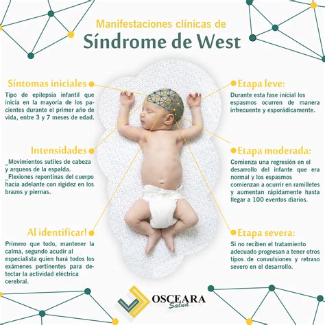 Sindrome De West Bebe