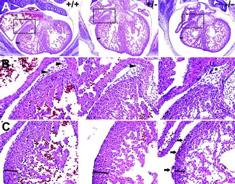 Coronary Vessel Development Is Dependent On The Type Iii Transforming