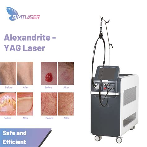 China alexandrite laser hair removal manufacturers, alexandrite laser ...