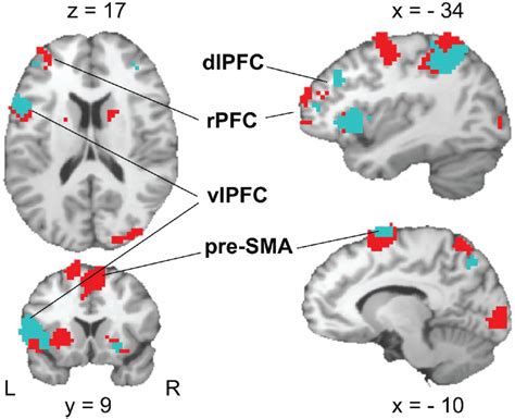 Activation Patterns In Brain Areas Associated With Rule Cue Induced