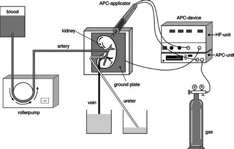 Argon Plasma Coagulation Apc For Endo Urological Procedures Ex Vivo