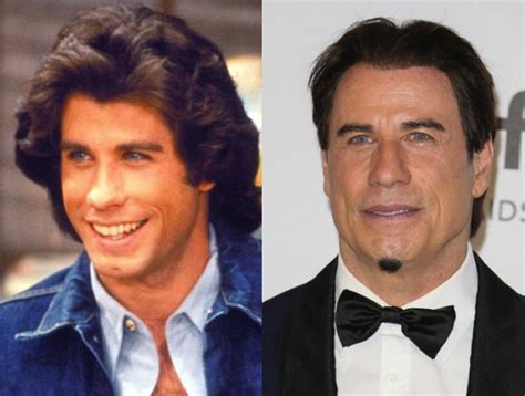 John Travolta Before And After Plastic Surgery Celebrity Plastic