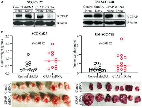 CPAP Depletion Enhances The Tumorigenic Properties Of OSCC Cell Lines