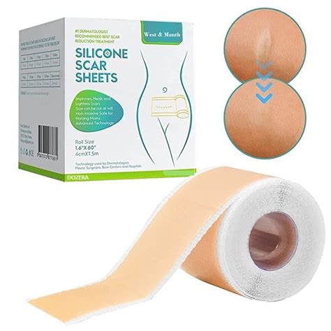 Dozera Silicone Scar Removal Sheets Scar Tape Roll Scar Treatment