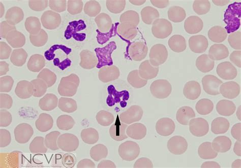 Rickettsia - NCVP - National Center for Veterinary Parasitology