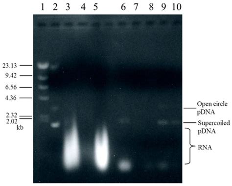 Membranes Free Full Text Separation Properties Of Plasmid DNA Using