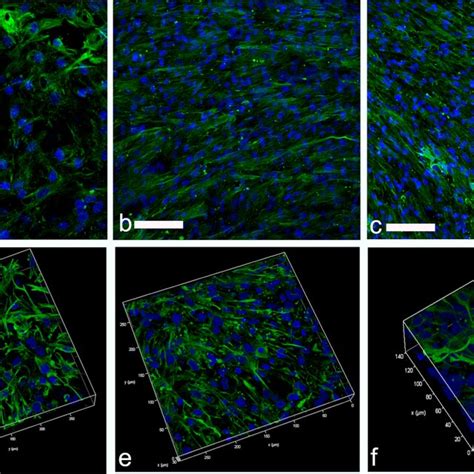 Expression of vimentin fibroblast marker in subepithelial stromal cells ...