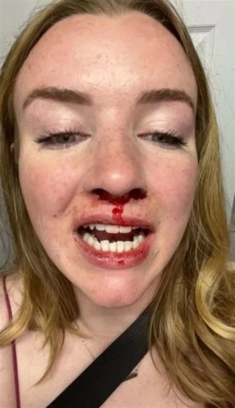 Horrifying Moment Gang Beat Up Lesbian Couple Celebrating Birthday The Mirror