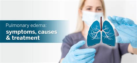 Pulmonary Edema: Symptoms, Causes and Treatment - Aakash Healthcare