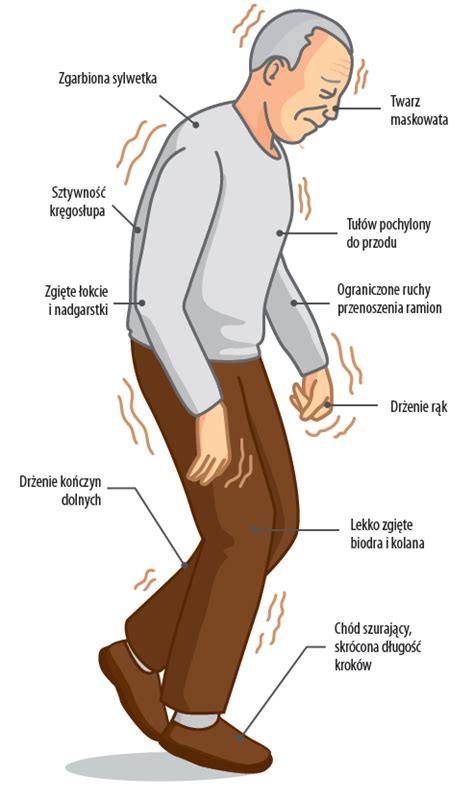 Fizjoterapia W Chorobie Parkinsona