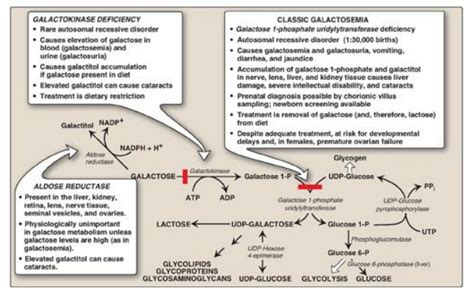 Galactosemia Pathway