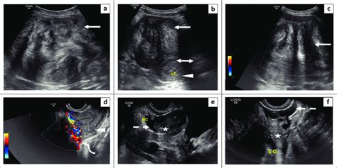 Grey Scale And Doppler Ultrasound Transverse A And Sagittal B Grey Download Scientific