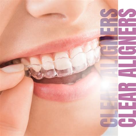 Clear Aligners Or Invisible Braces Aurum Dentistry