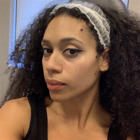 No One Talks About How Much Your Moles Change When You're Pregnant