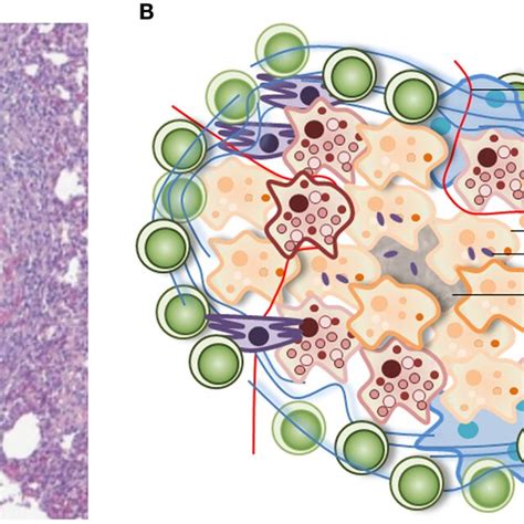 Typical Architecture Of A Tb Granuloma A Representative Granuloma Download Scientific