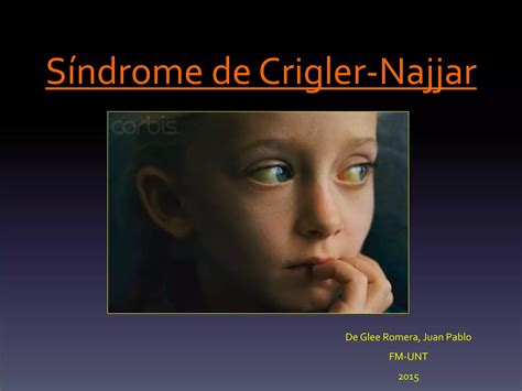 Sindrome De Kartagener 3