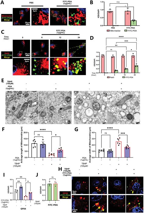 Polydopamine Nanoparticles Targeting Ferroptosis Mitigate Intervertebral Disc Degeneration Via