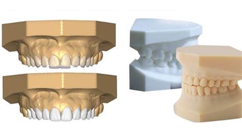 Aprender Sobre Imagem Modelo Odontologico Br Thptnganamst Edu Vn