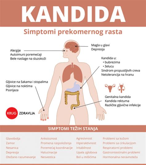 Kandida i Kandidijaza Šta su koji su simptomi dijagnostika i lečenje