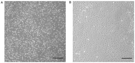 Morphology Of Adipose Derived Stem Cells At A P And B P Under An