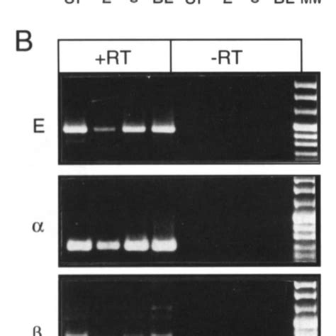 A Representative Semiquantitative Reverse Transcription Polymerase