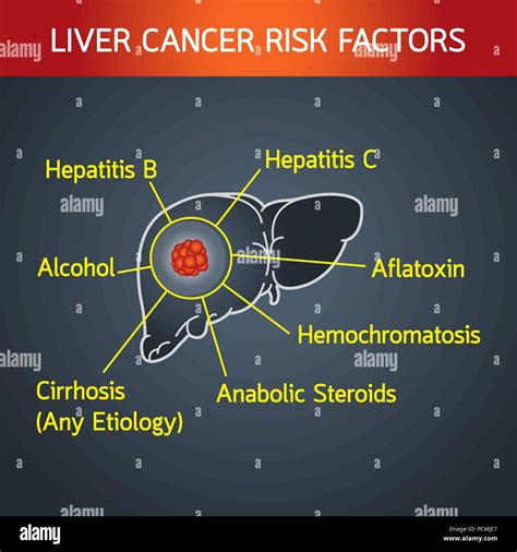 Liver Cancer Risk Factors Vector Logo Icon Illustration Stock Vector Image And Art Alamy