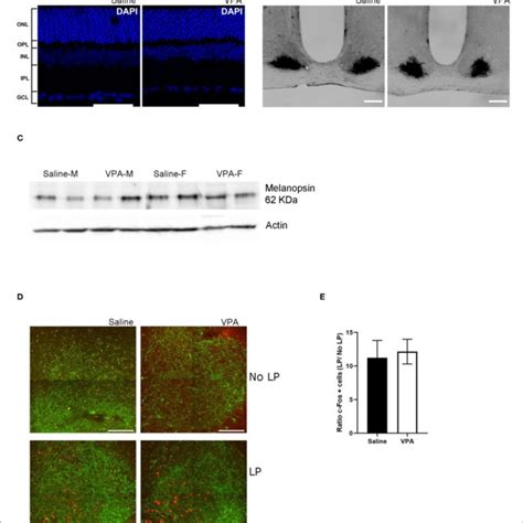 In Utero Vpa Exposure Does Not Alter Retinal Organisation A