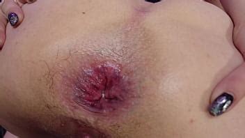 Luna Rival Culo Destruido Squirting Grandes Aberturas Anales Xvideos