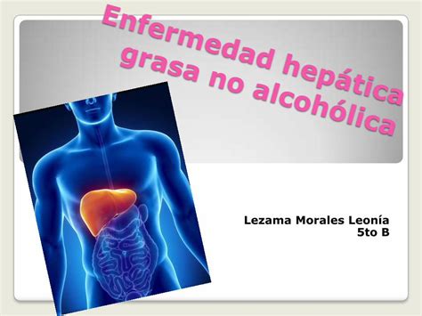 Pdf Enfermedad Hepática Grasa No Alcohólica Ehna Pdfslidenet