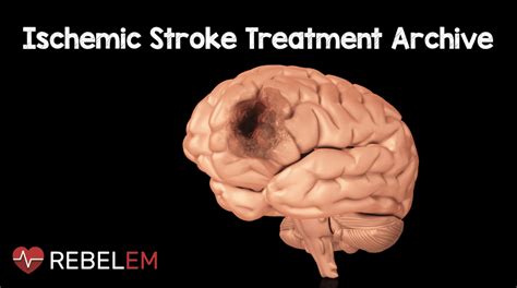 Ischemic Stroke Treatment Archive - REBEL EM - Emergency Medicine Blog