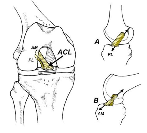 treatment  prevention  anterior cruciate ligament injuries