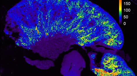 High Resolution Elemental Imaging Of Biological Tissue