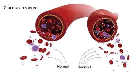 Factores Que Afectan Su Nivel De Glucosa En La Sangre Federación