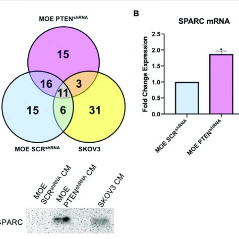 A Venn Diagram Of Proteins Identified From Proteomics Analysis In