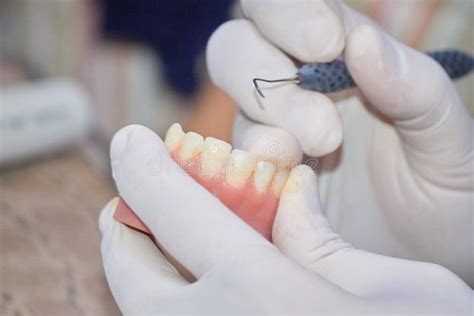 Dental Technician Working in a Lab Stock Photo - Image of denture ...