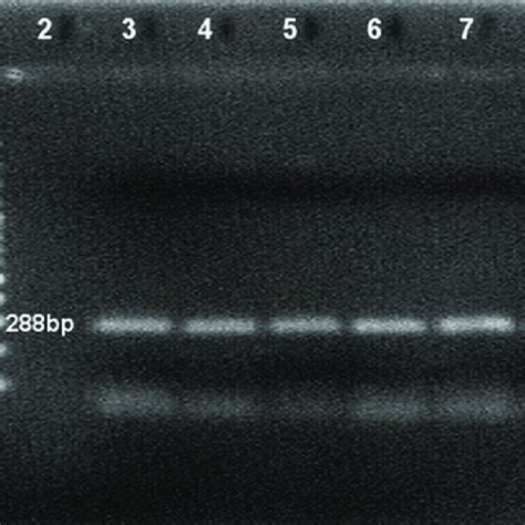 Reverse Transcription Polymerase Chain Reaction Analysis Of Samples For