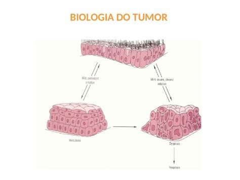 PPT BIOLOGIA DO TUMOR Tumores Benignos Malignos Bem Diferenciados