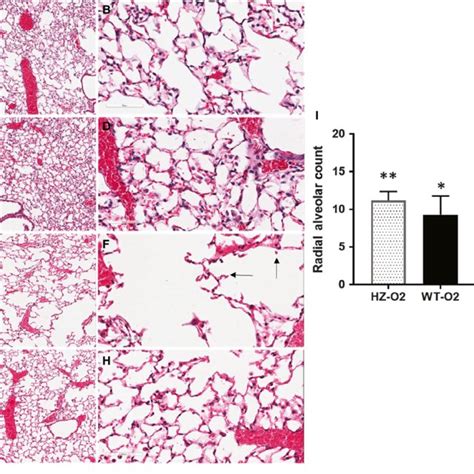 Survival studies. Nfib hemizygous mice (white circles) and wild-type ...