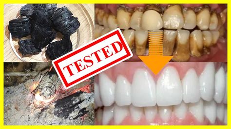 How To Whiten Teeth At Home Naturally In 3 Minutes Using Charcoal 2020