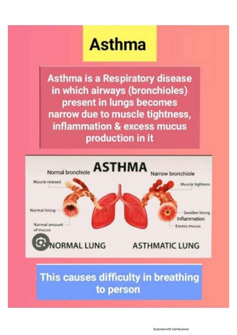 Solution Pharmacology Of Drugs Acting On Respiratory System Studypool