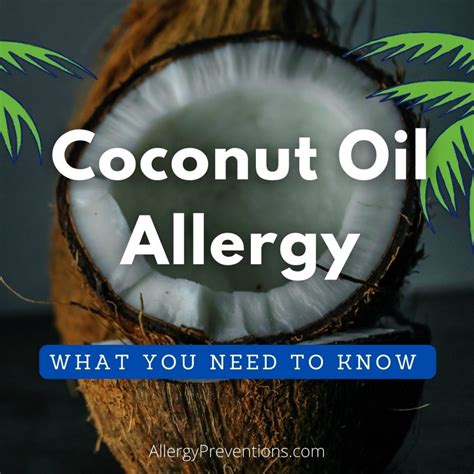 Coconut Oil Allergy: What You Need to Know - Allergy Preventions